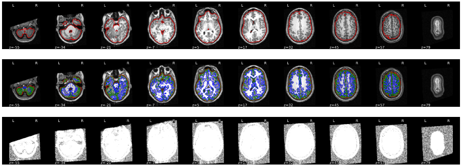 t1 verbose masks 1