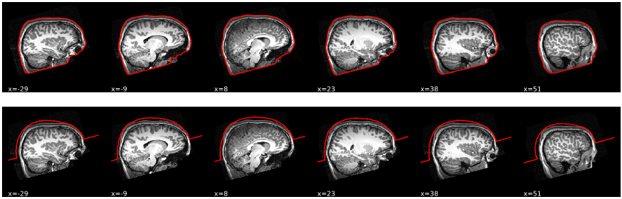 t1 verbose masks 2