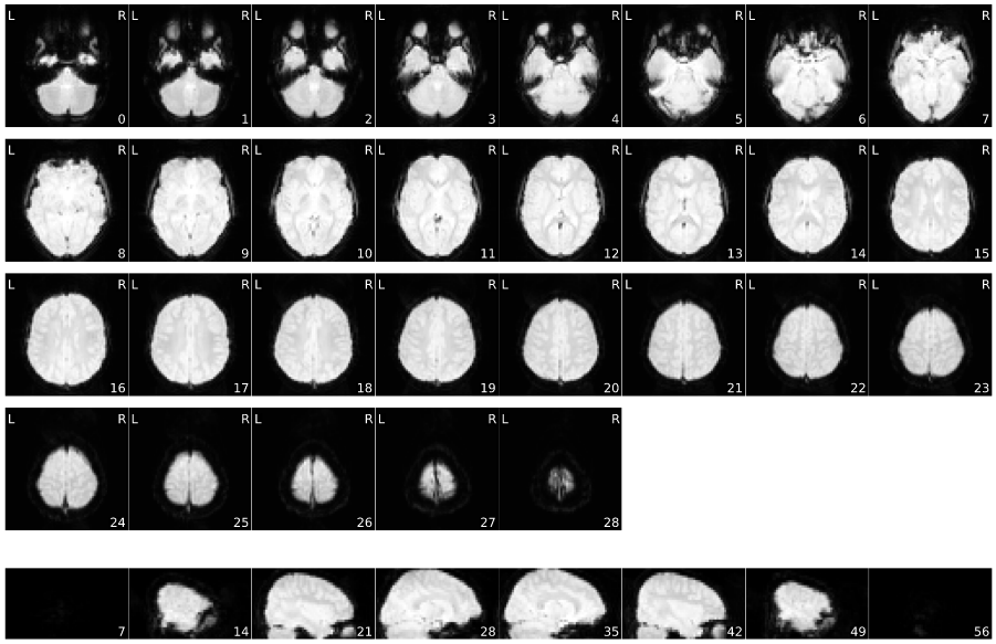 mean epi mosaic