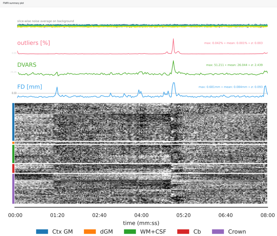 fMRI summary plot