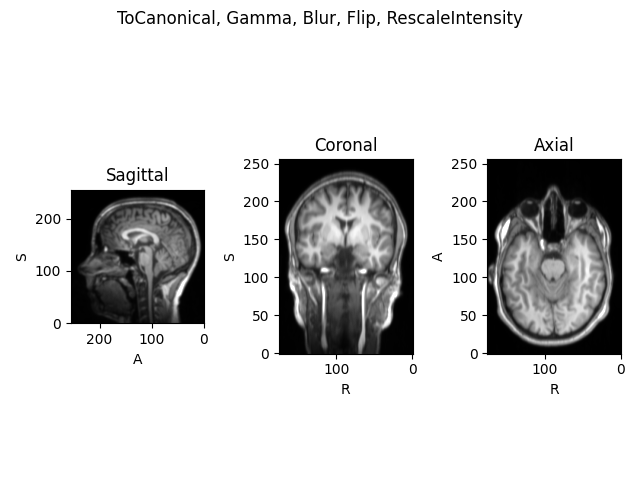 ToCanonical, Gamma, Blur, Flip, RescaleIntensity, Sagittal, Coronal, Axial