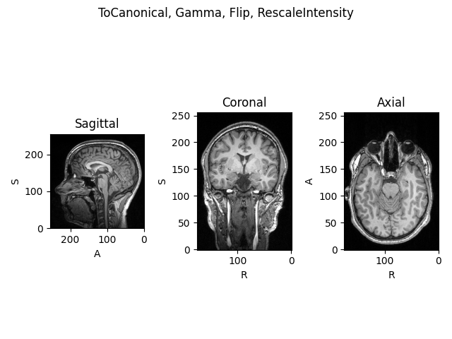 ToCanonical, Gamma, Flip, RescaleIntensity, Sagittal, Coronal, Axial