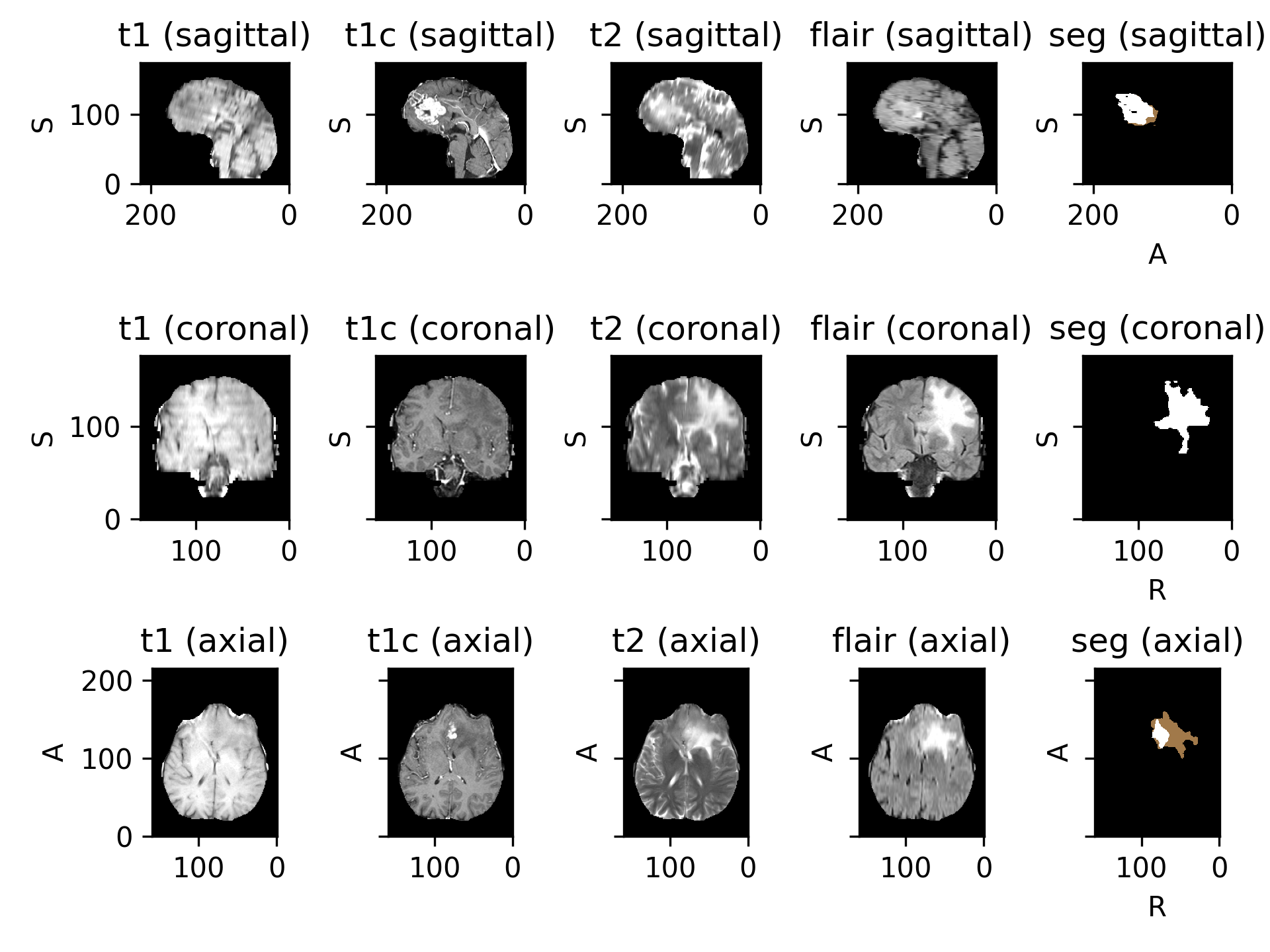 ../_images/datasets-4.png