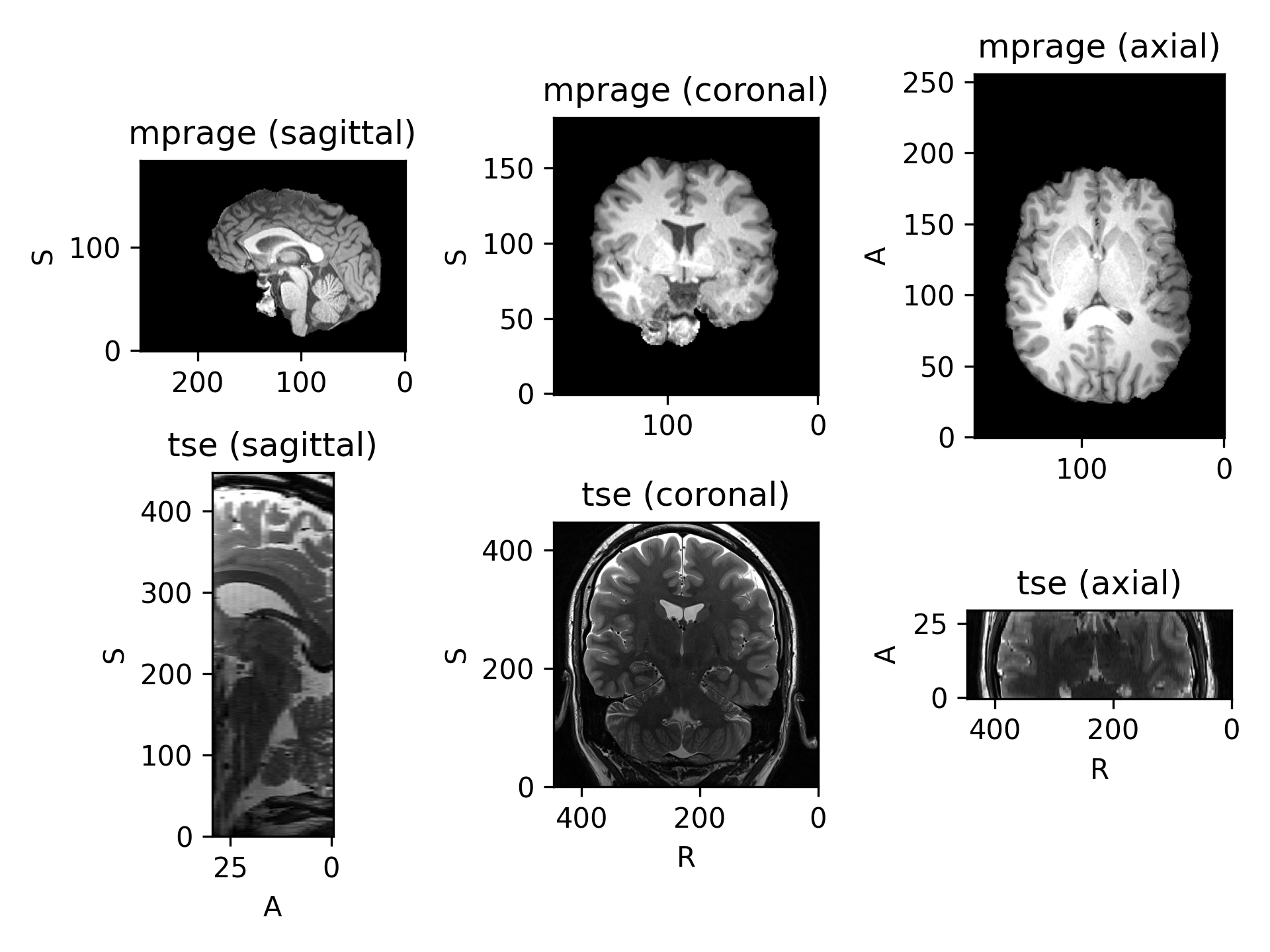 ../_images/datasets-5.png