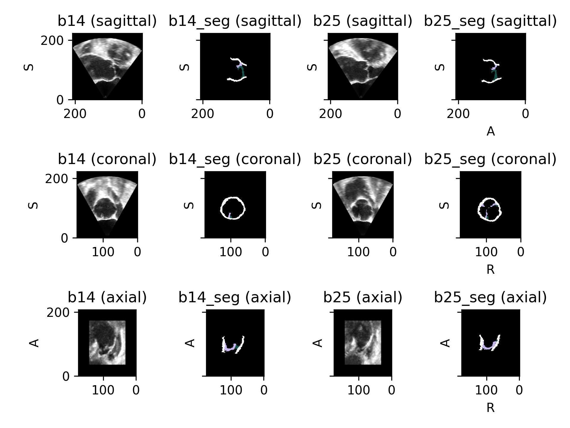 ../_images/datasets-6.png