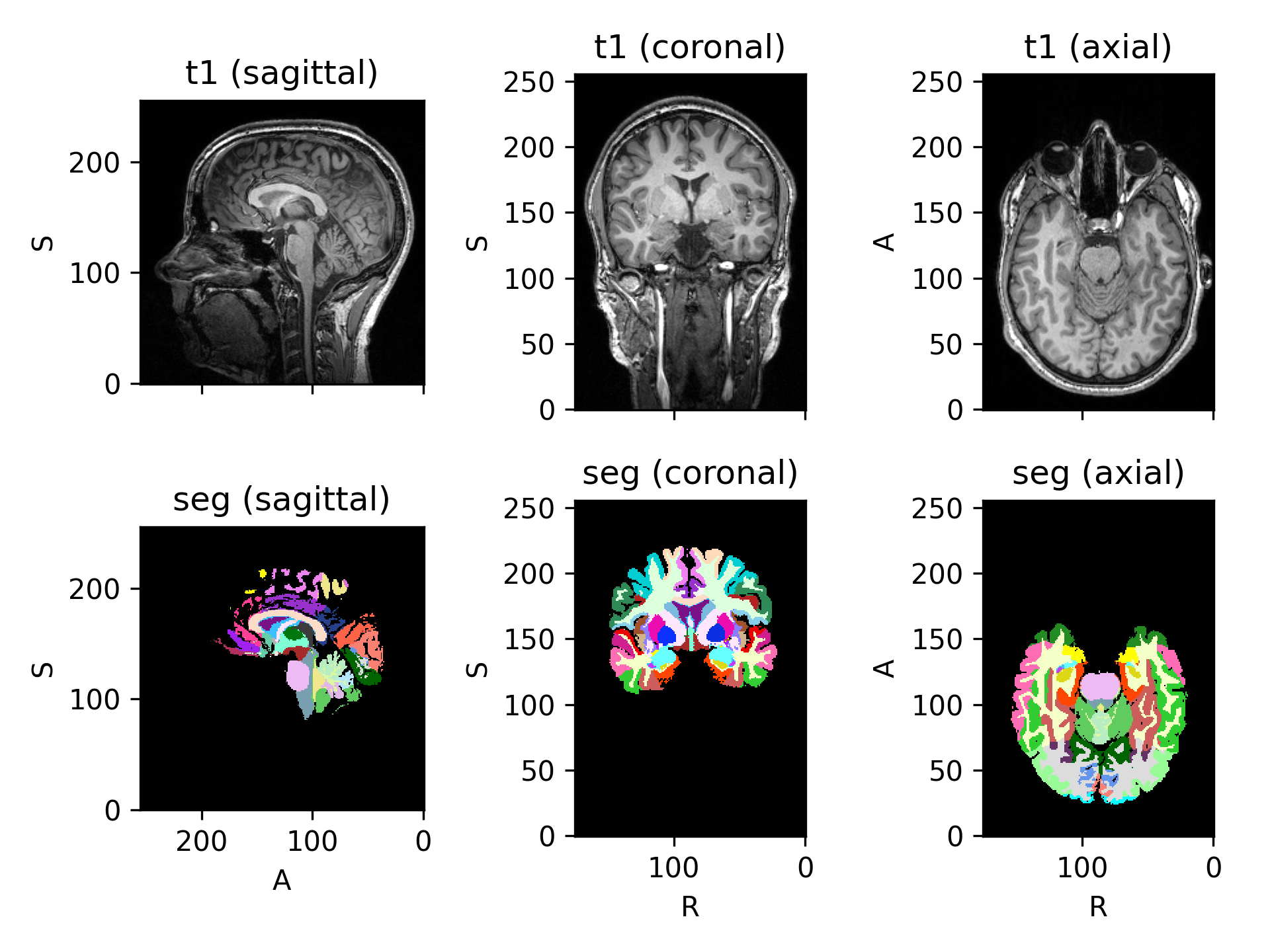 ../_images/datasets-8.png