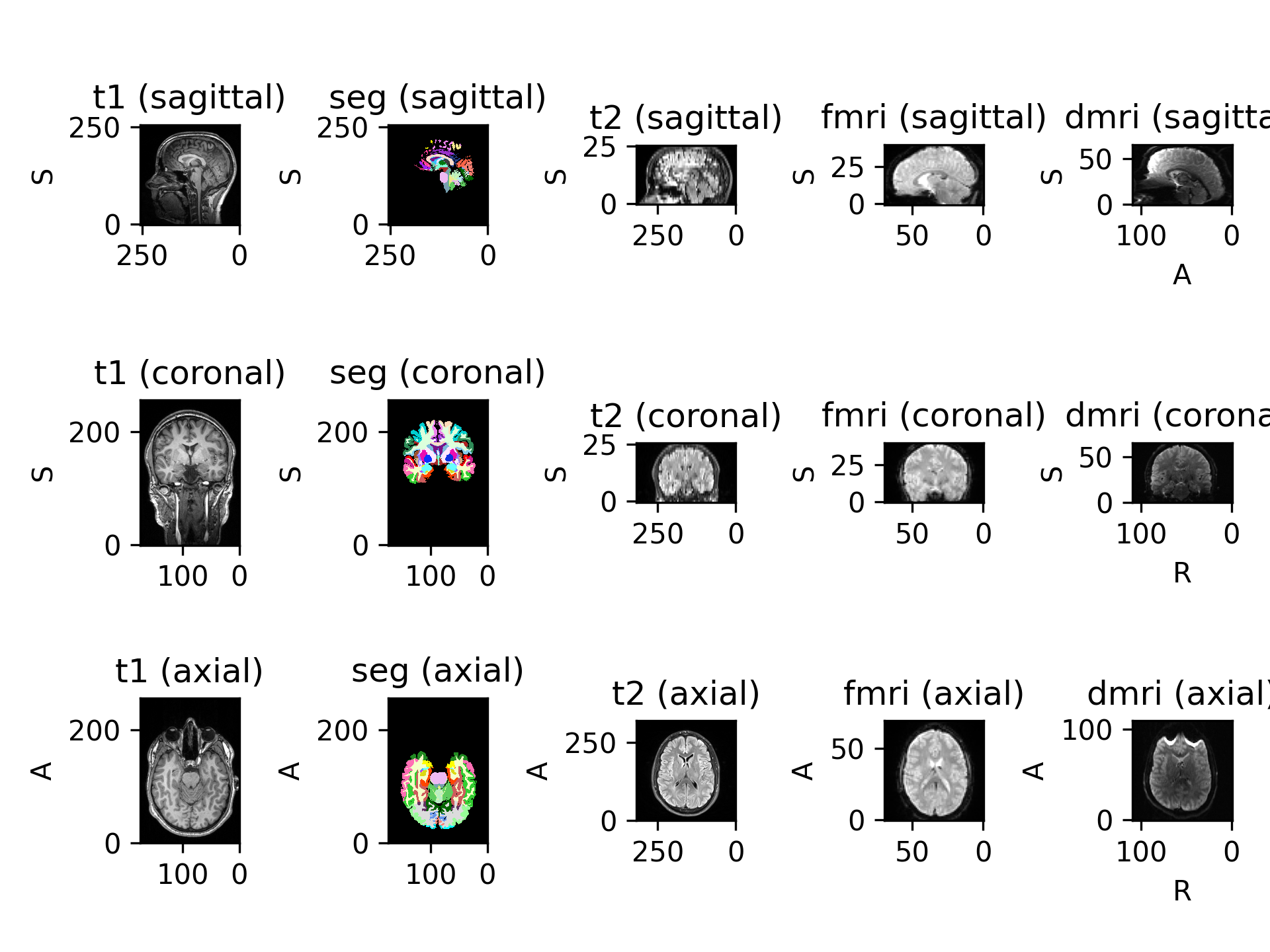 ../_images/datasets-9.png