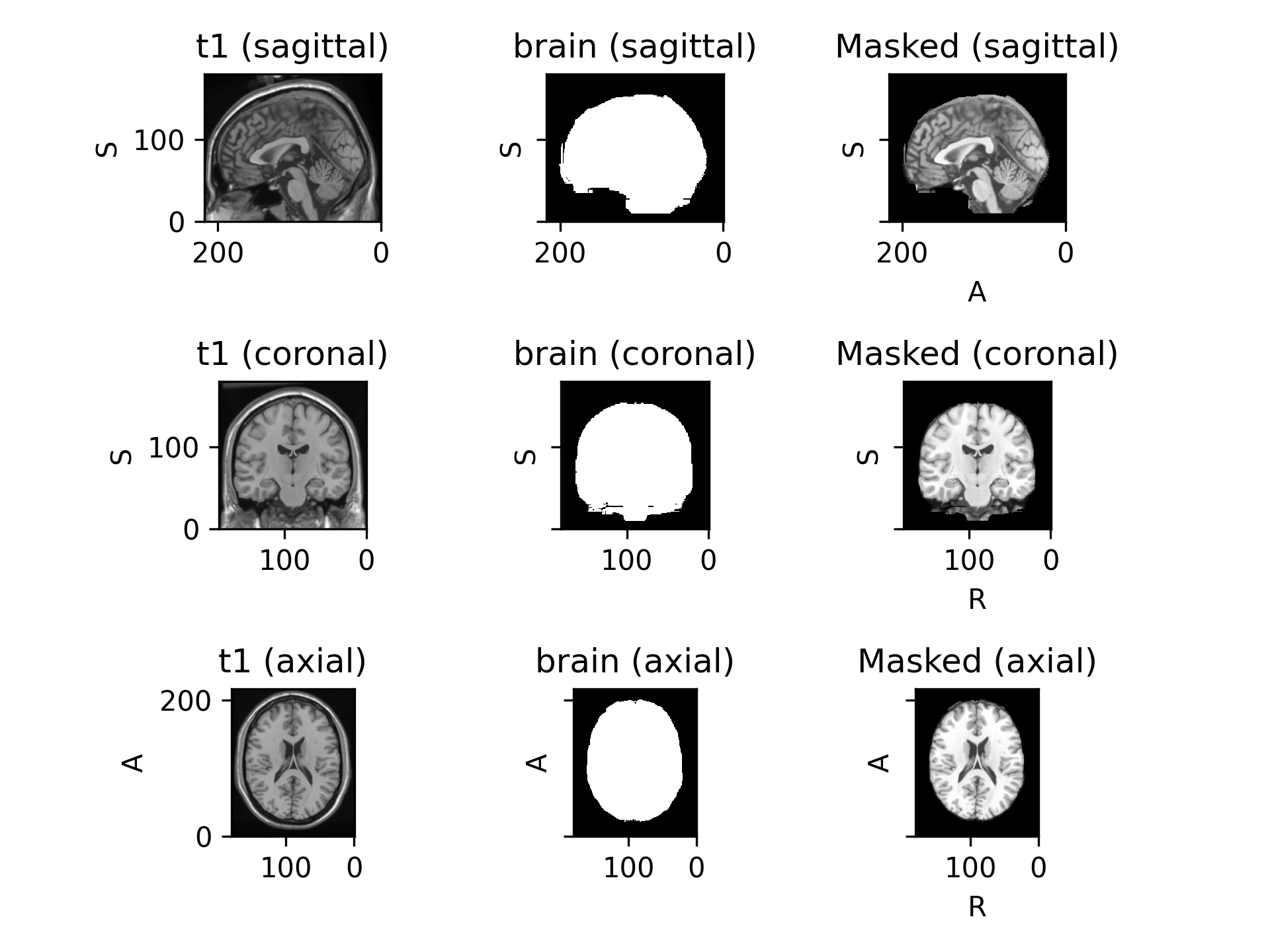 ../../_images/preprocessing-1.png