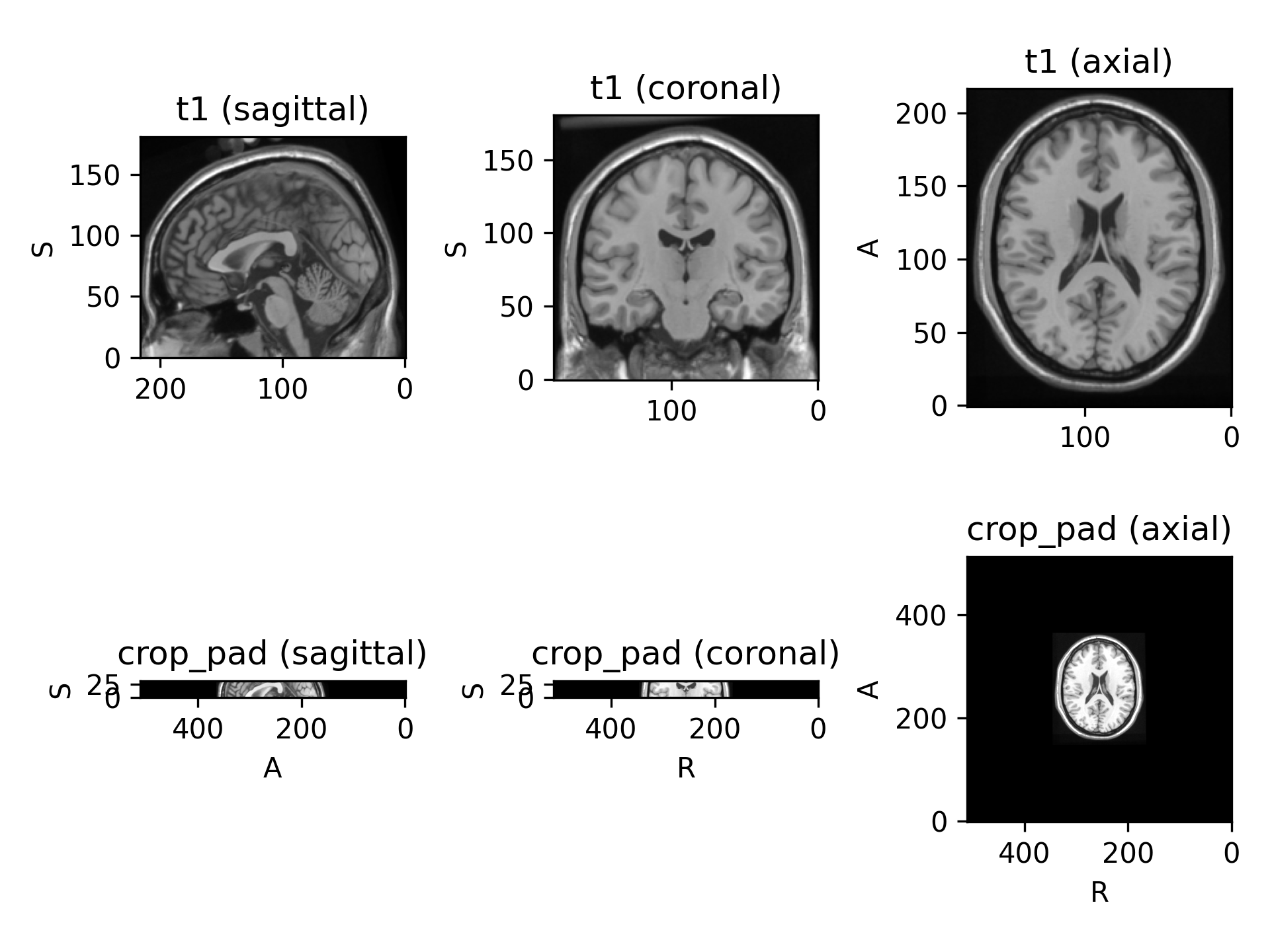 ../../_images/preprocessing-3.png