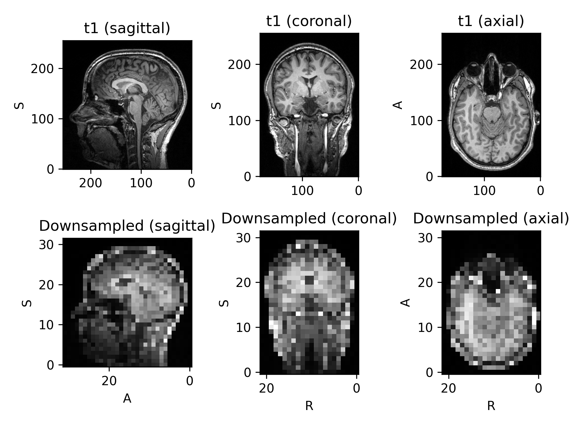 ../../_images/preprocessing-4.png