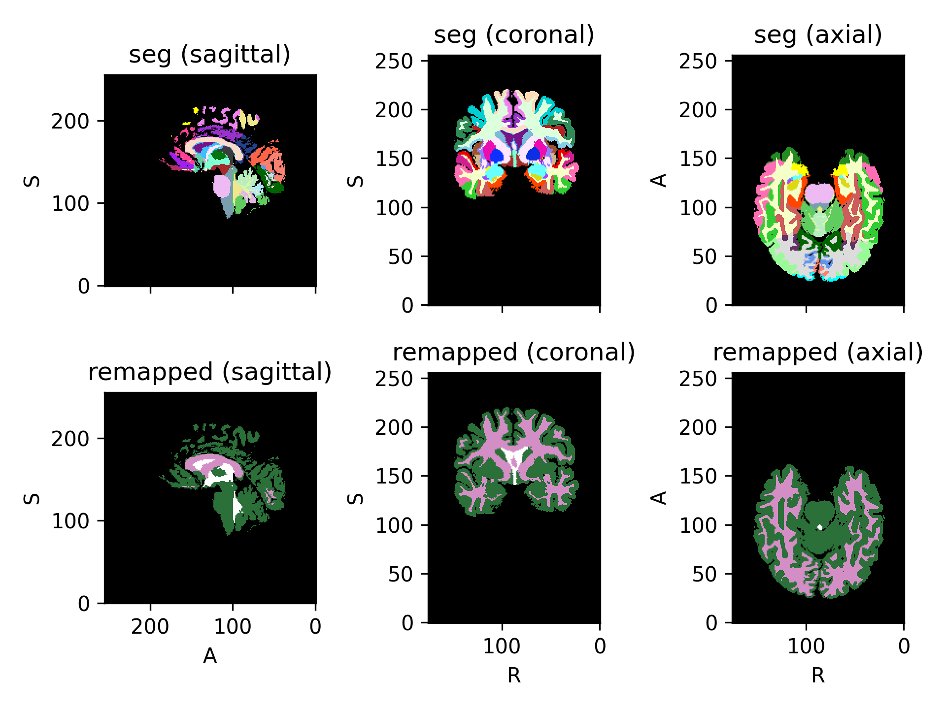 ../../_images/preprocessing-5.png