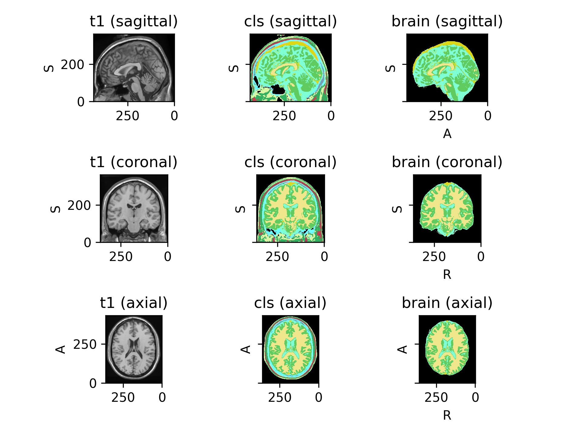 ../../_images/preprocessing-6.png