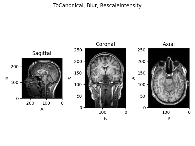 ToCanonical, Blur, RescaleIntensity, Sagittal, Coronal, Axial