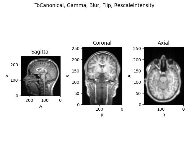 ToCanonical, Gamma, Blur, Flip, RescaleIntensity, Sagittal, Coronal, Axial