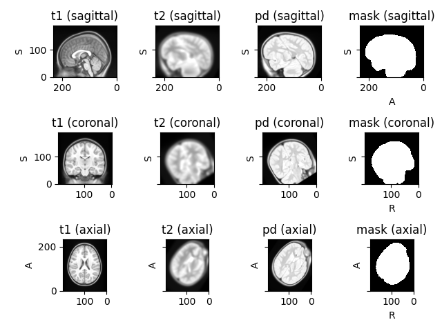 t1 (sagittal), t2 (sagittal), pd (sagittal), mask (sagittal), t1 (coronal), t2 (coronal), pd (coronal), mask (coronal), t1 (axial), t2 (axial), pd (axial), mask (axial)